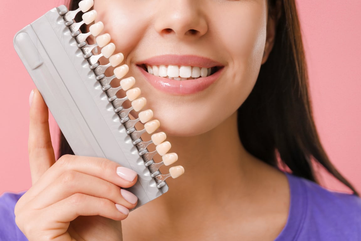 Woman and Teeth Veneers